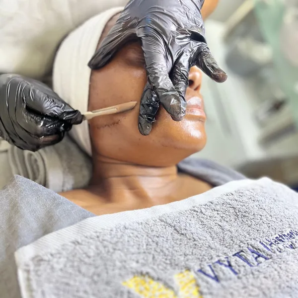 Embrace Your Glow with Vyta Aesthetics and Hair Transplant