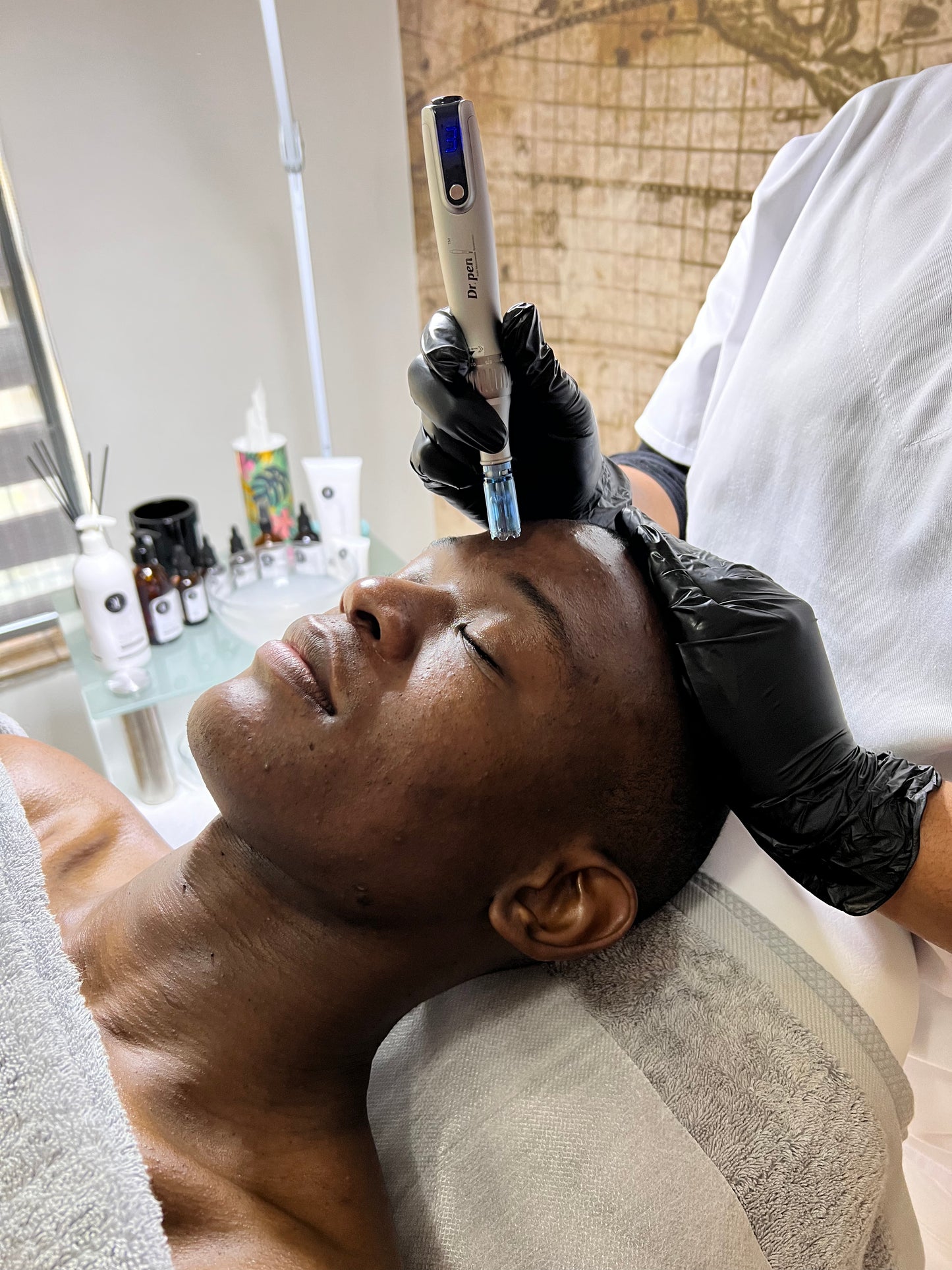 Microneedling Facial Treatment